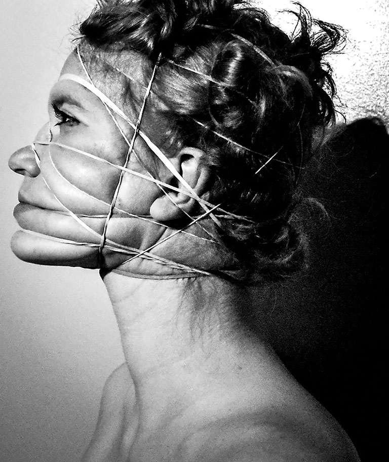 A photo of a young girl with rubber bands tightly wrapped around her face