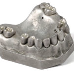 A silver denture mold.
